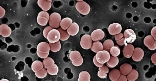 Pediococcus Pediococcus