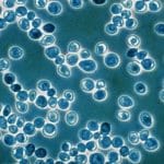 Introducción al Brettanomyces