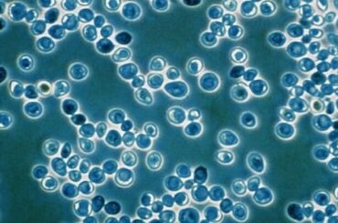 Introducción al Brettanomyces