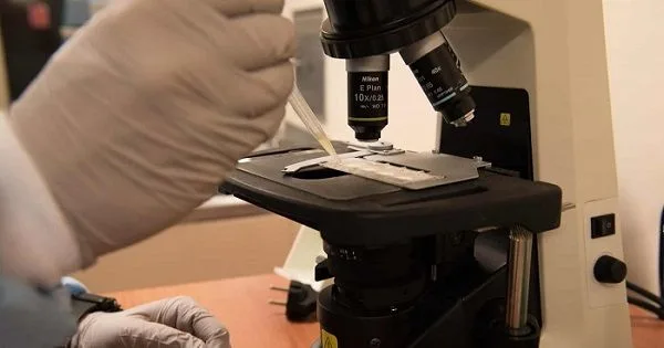 Microscopio cerveza