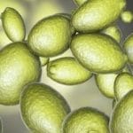 Síndrome de fermentación automática