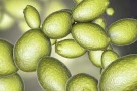 Síndrome de fermentación automática