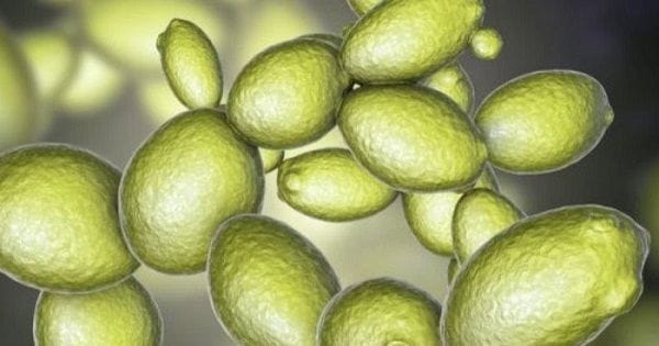 Síndrome de fermentación automática Síndrome de fermentación automática
