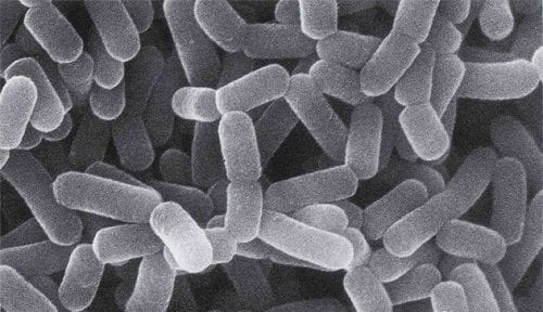 Lactobacillus en la cerveza Lactobacillus en la cerveza