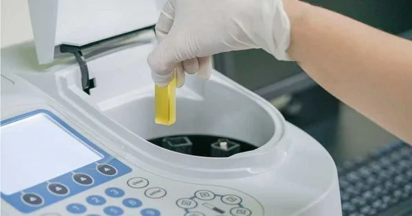 Cálculo de IBU en espectrofotómetro