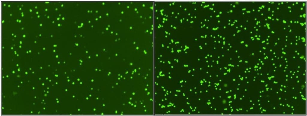 Cultivo celular que muestra una intensidad de fluorescencia variada (izquierda) y un cultivo celular que muestra una intensidad de fluorescencia uniforme (derecha).