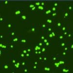 Midiendo la vitalidad de las células de levadura