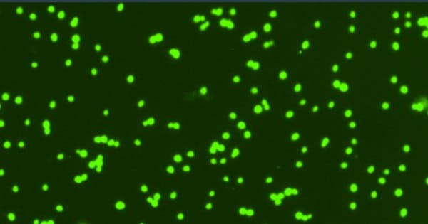 Midiendo la vitalidad de las células de levadura