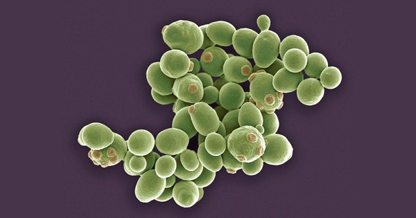 Saccharomyces cerevisiae var. chevalieri