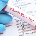 Vitamina B12