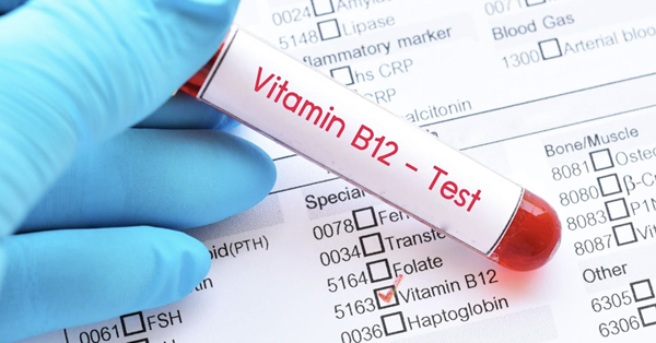 Vitamina B12