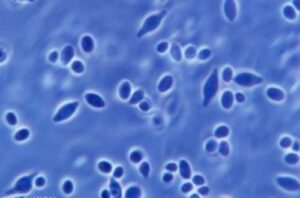 Hanseniaspora uvarum Hanseniaspora uvarum